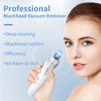Blackhead Vacuum Cleaner – Deep Pore Suction, Multi‑Head Design, For Clear & Smooth Skin