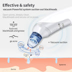 Blackhead Vacuum Cleaner – Deep Pore Suction, Multi‑Head Design, For Clear & Smooth Skin