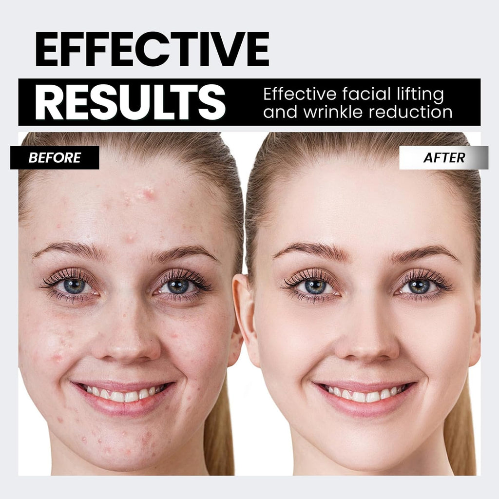 Anti‑Aging Microcurrent Skin Lifter