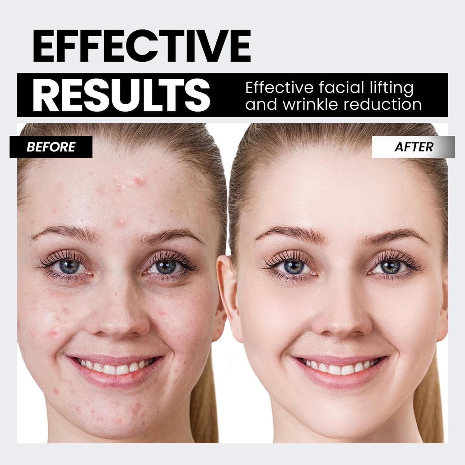 Anti‑Aging Microcurrent Skin Lifter