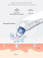 Blackhead Vacuum Cleaner – Deep Pore Suction, Multi‑Head Design, For Clear & Smooth Skin